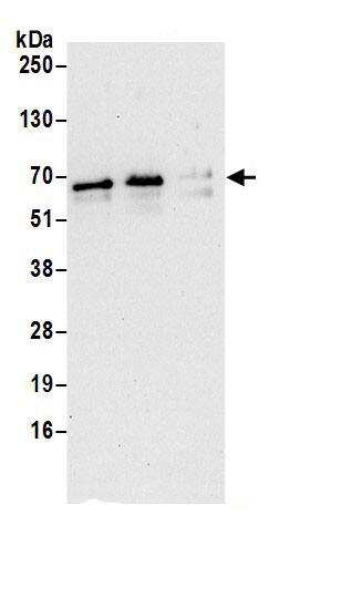 PGM3 Antibody