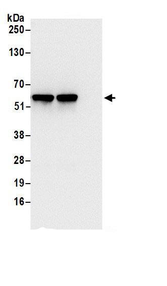 TCP1-eta Antibody