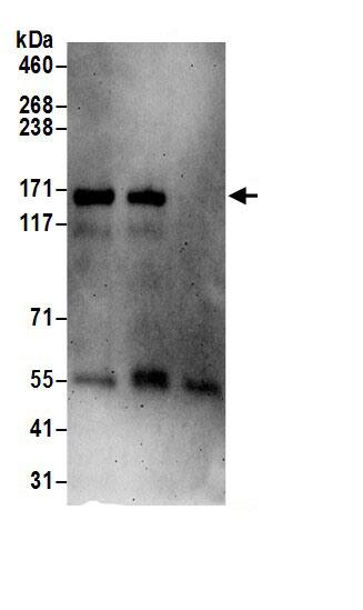 PTK7/CCK4 Antibody