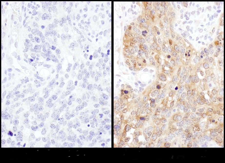 ADE2 Antibody