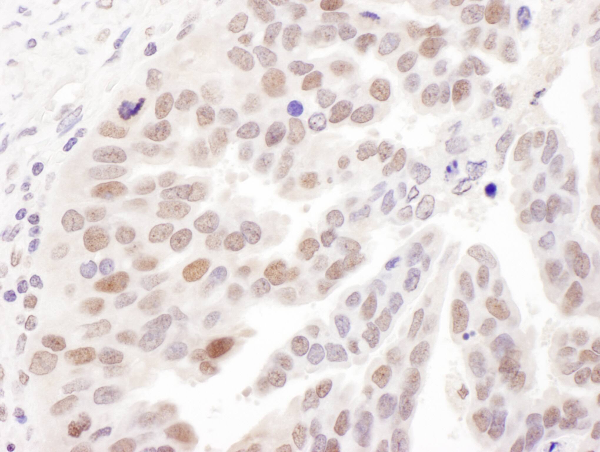 DNA Polymerase delta, catalytic subunit Antibody