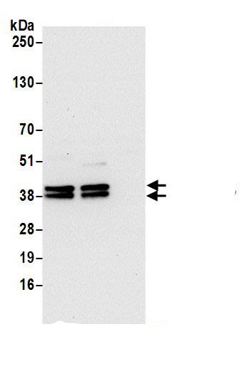 VTA1 Antibody