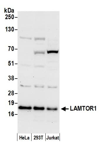 LAMTOR1 Antibody