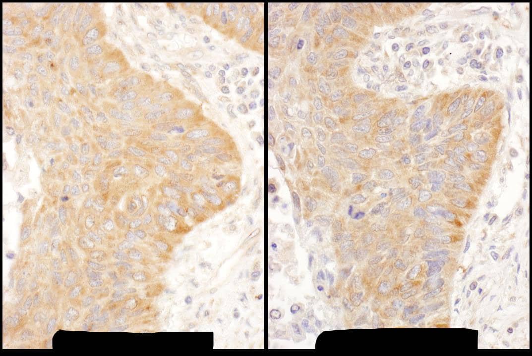 IMP2/IGF2BP2 Antibody