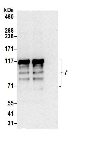 ARHGAP17 Antibody