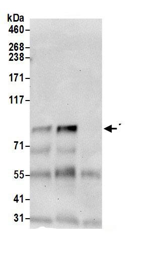 TBL3 Antibody