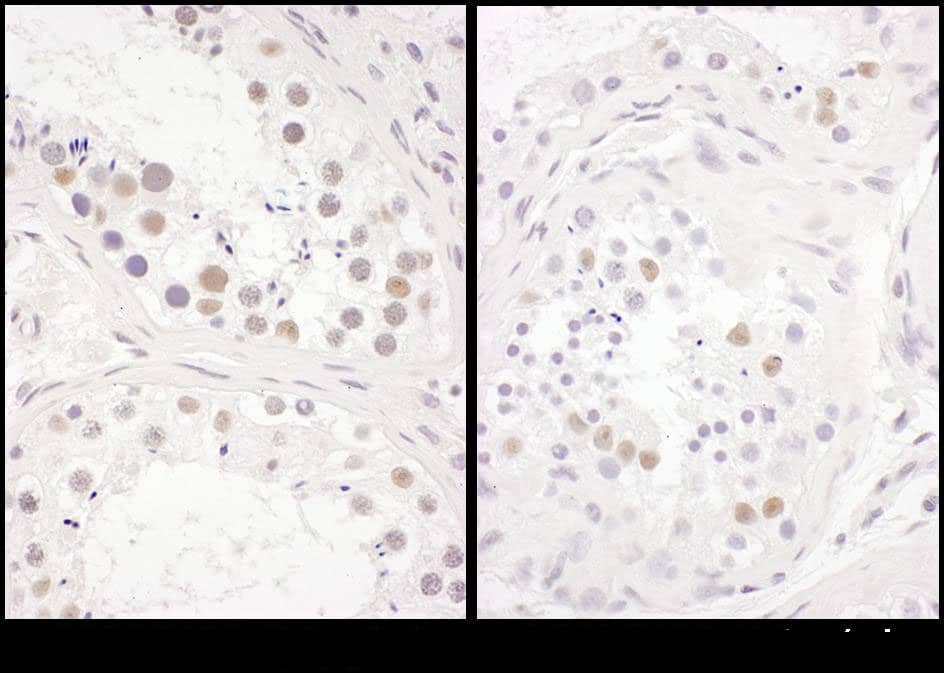 CINAP Antibody