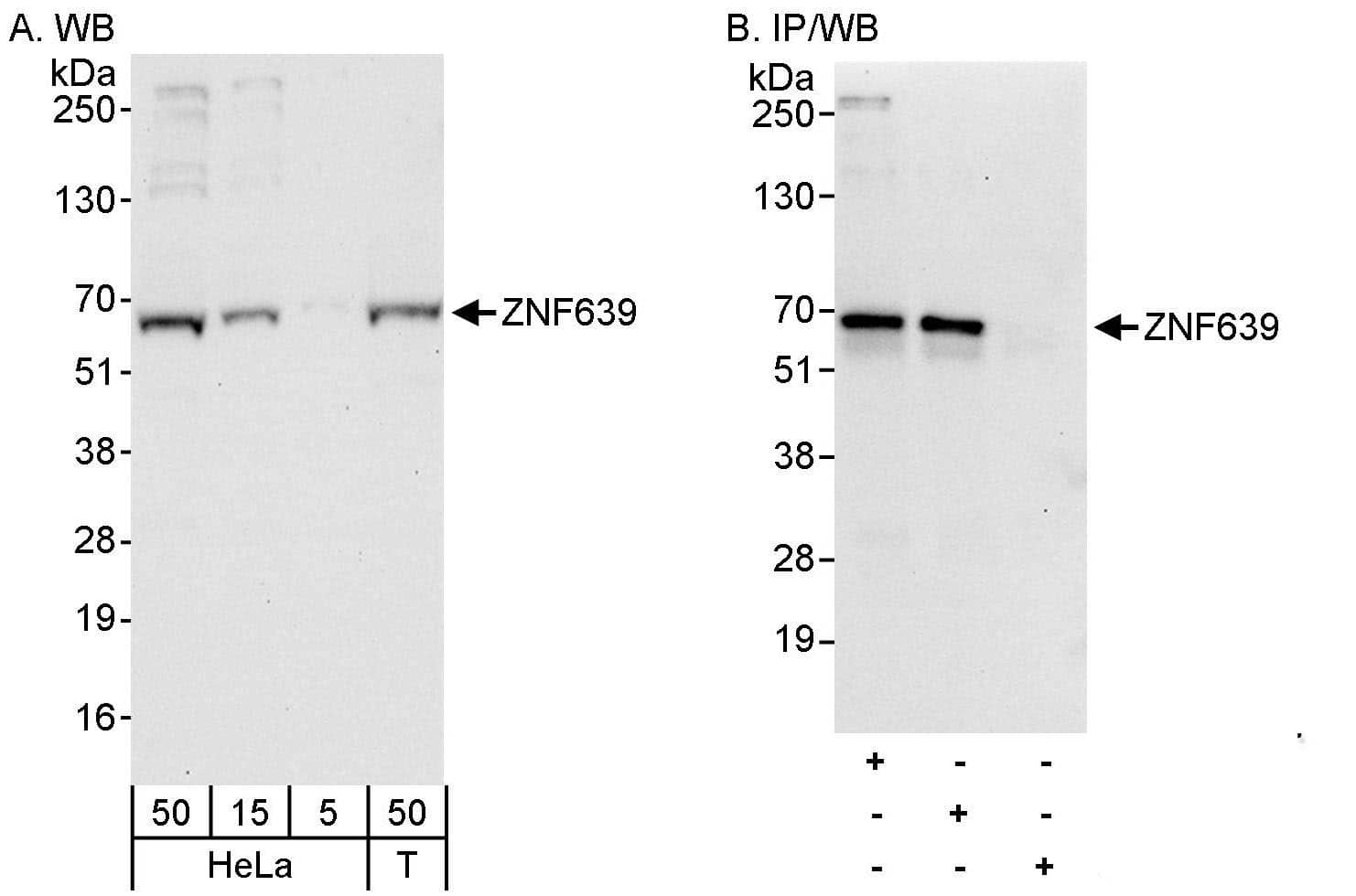 Zinc finger protein 639 Antibody