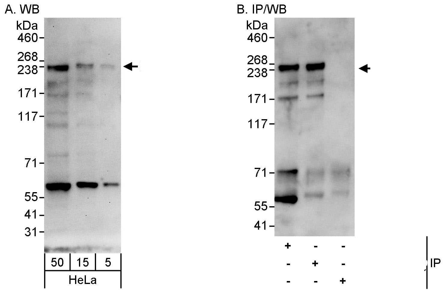 CEP152 Antibody