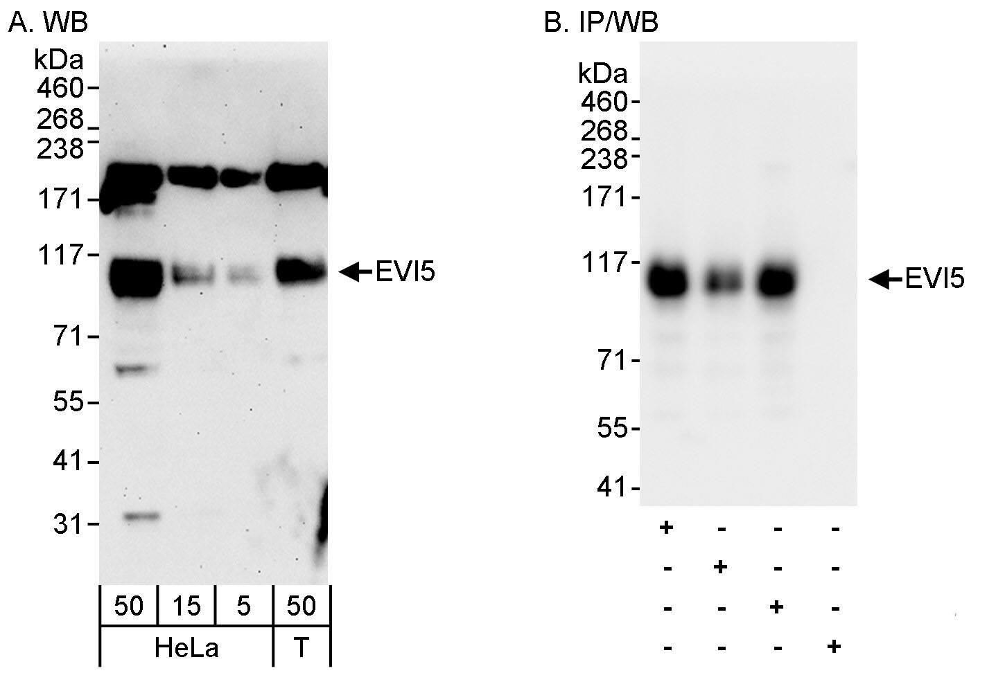 EVI5 Antibody