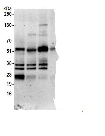 Stanniocalcin 2/STC-2 Antibody