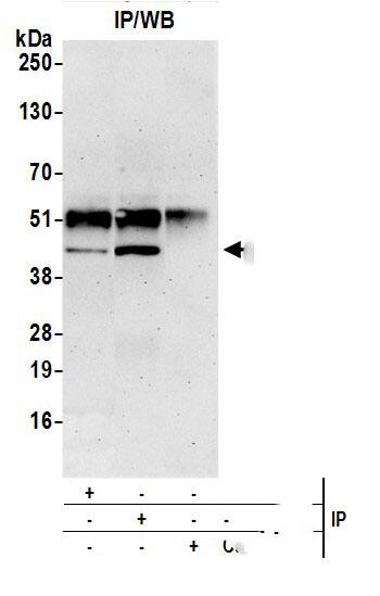 EBNA1BP2 Antibody