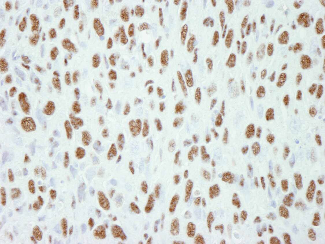 TCERG1 Antibody