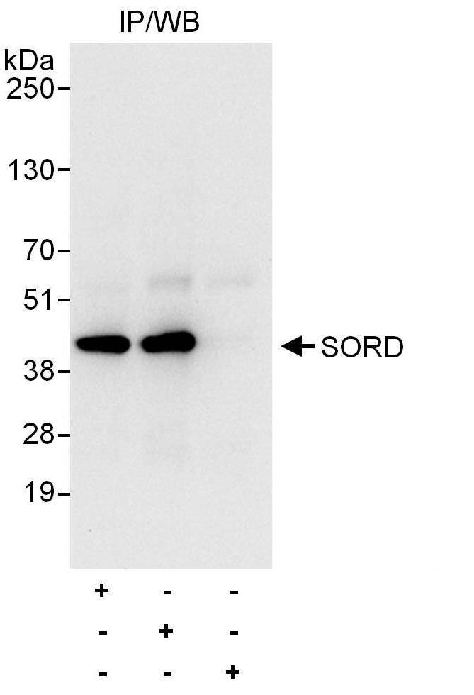 Sorbitol Dehydrogenase Antibody