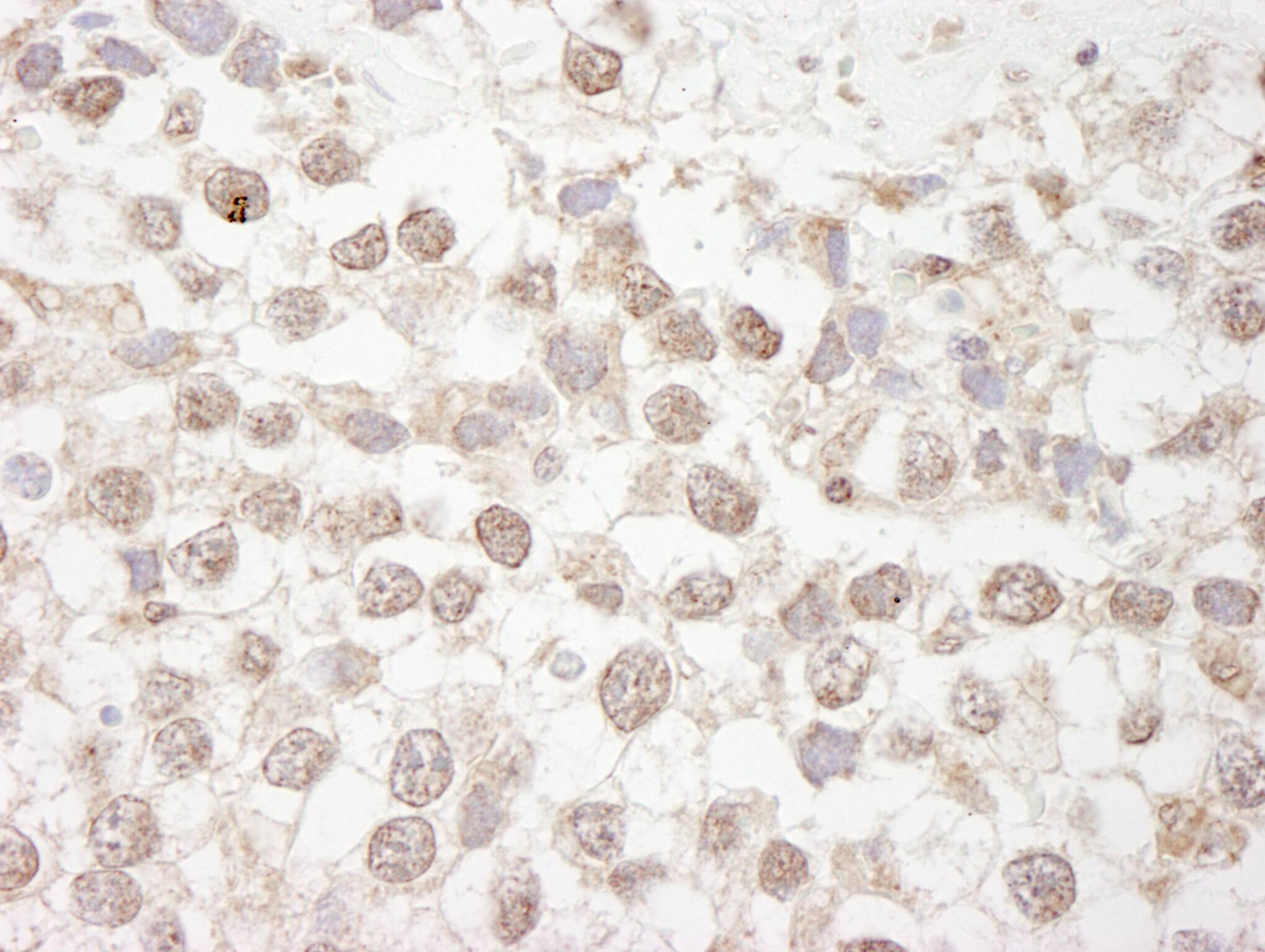 MBD4 Antibody