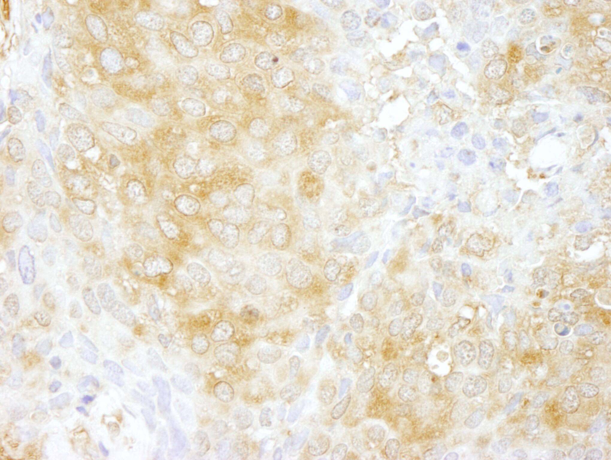 ARHGAP1 Antibody