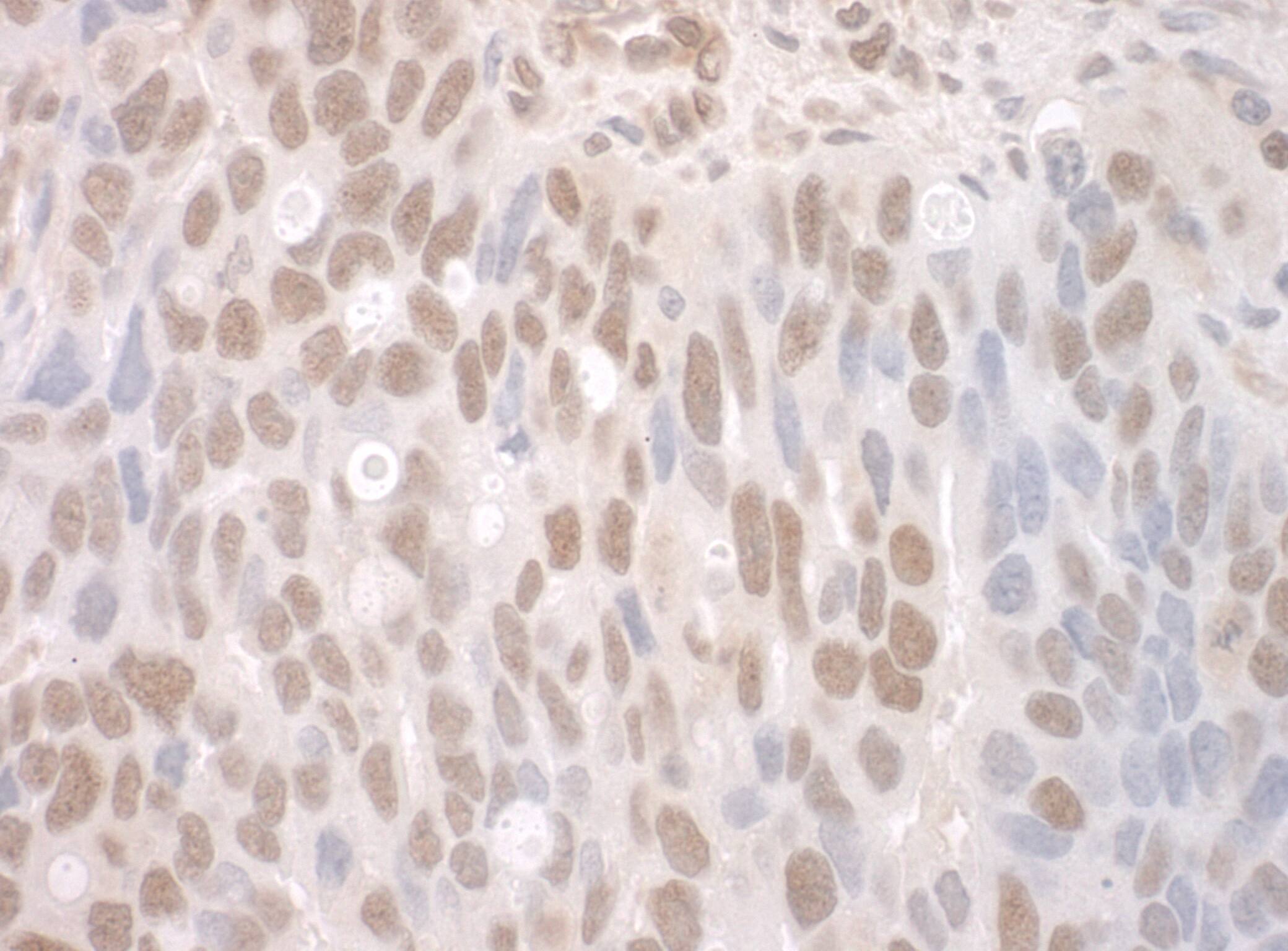 CTNNBL1 Antibody