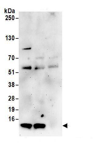 TIMM8A Antibody