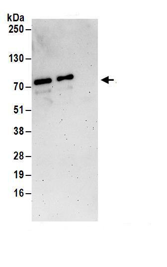 ZNF358 Antibody