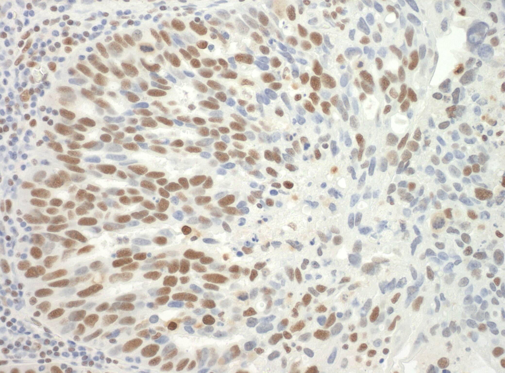 SAP130 Antibody