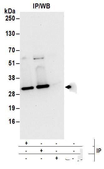 UBE2S Antibody