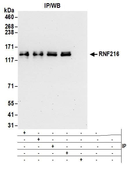 TRIAD3 Antibody