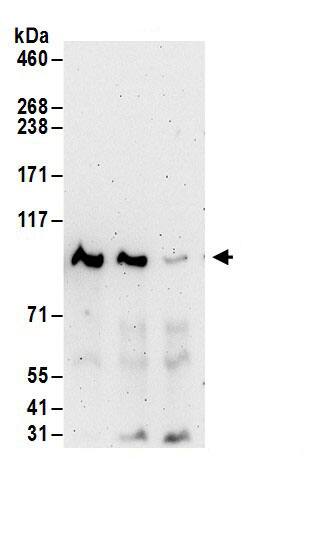 PRMT10 Antibody