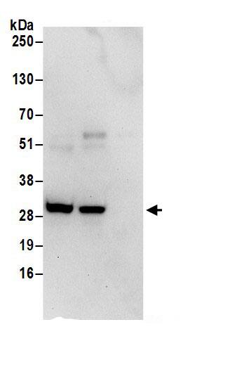 CHMP2B Antibody