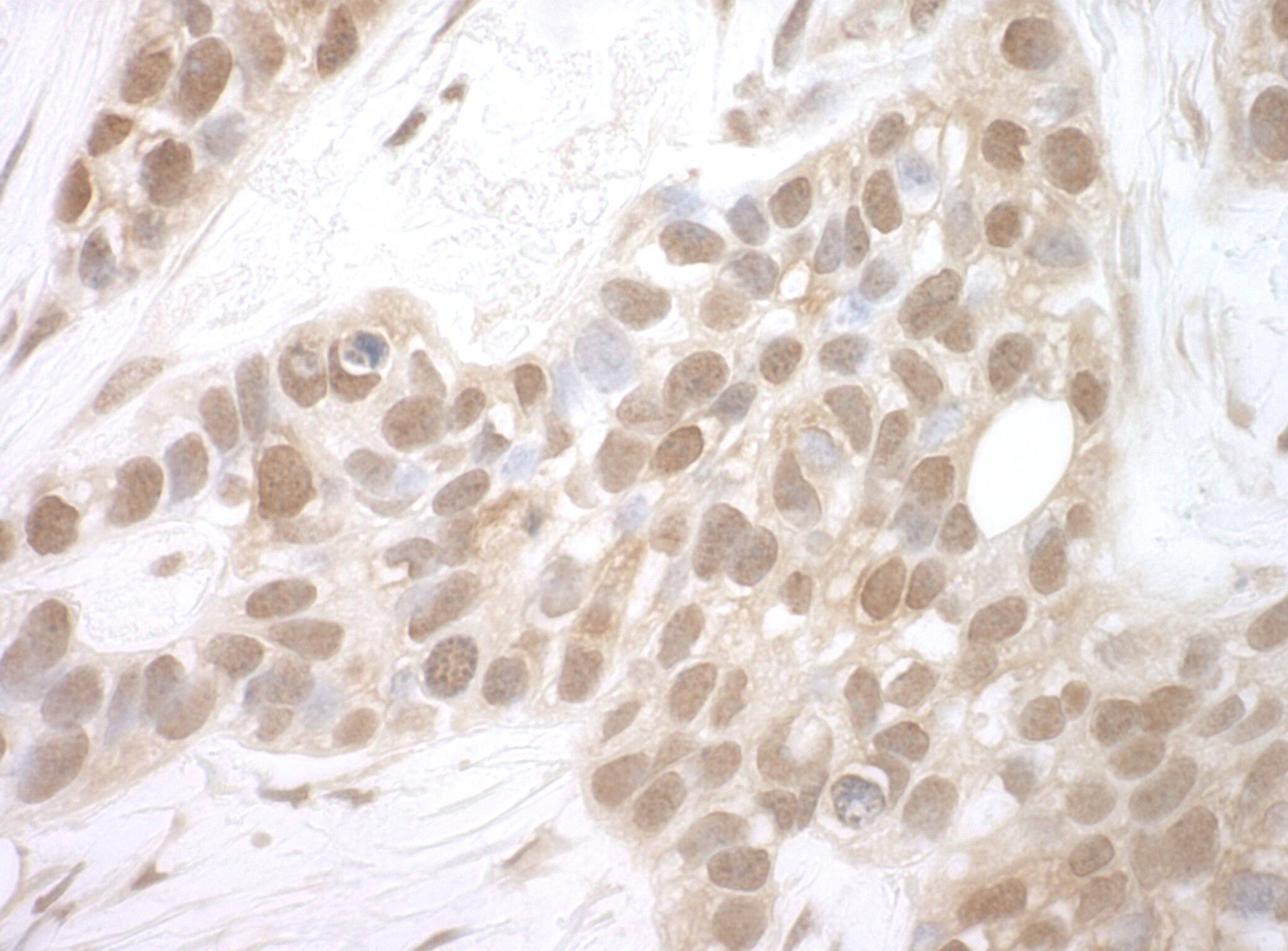 MERIT40/HSPC142 Antibody