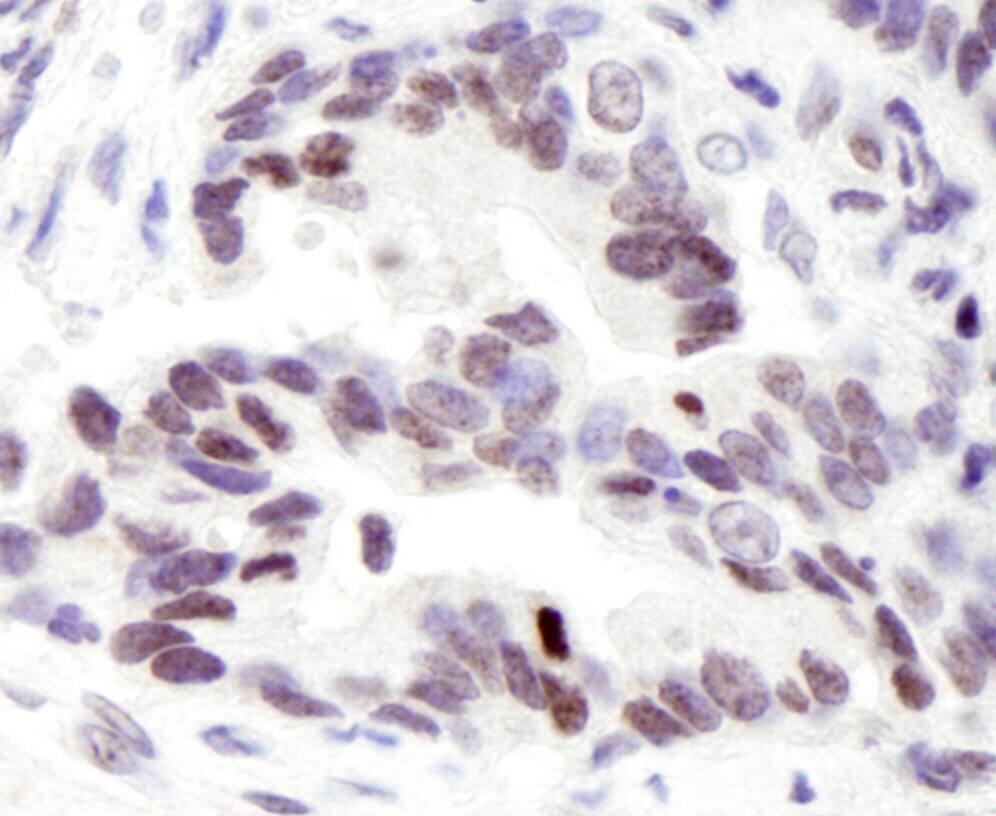 NCOA6 Antibody
