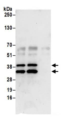 CDV3 Antibody