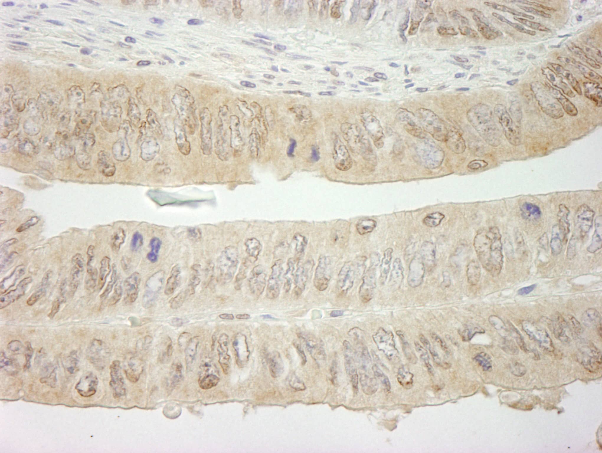 SYK Antibody