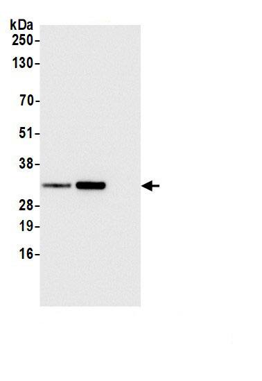 EFHD2 Antibody