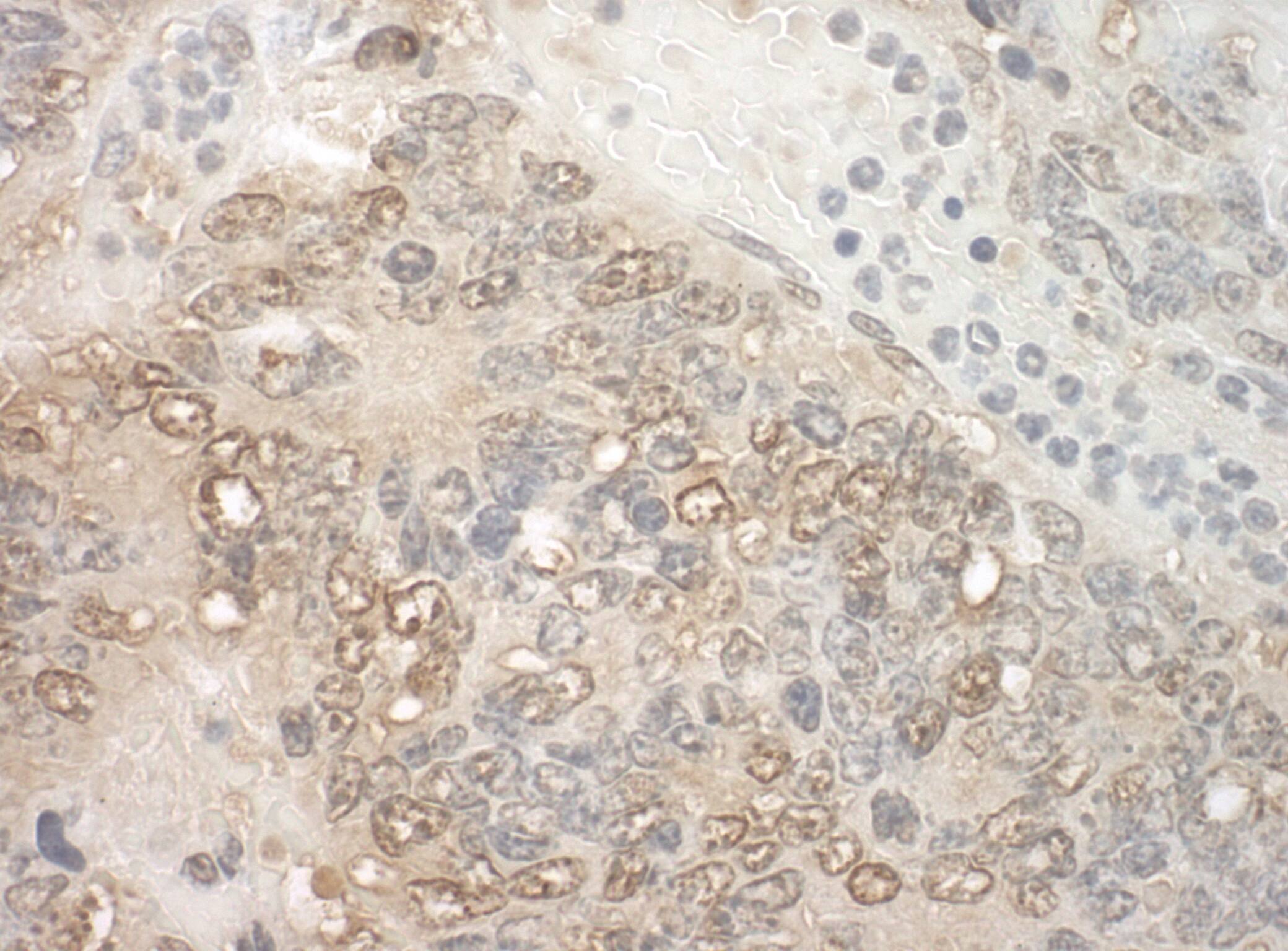 ZCCHC11/TUT4 Antibody