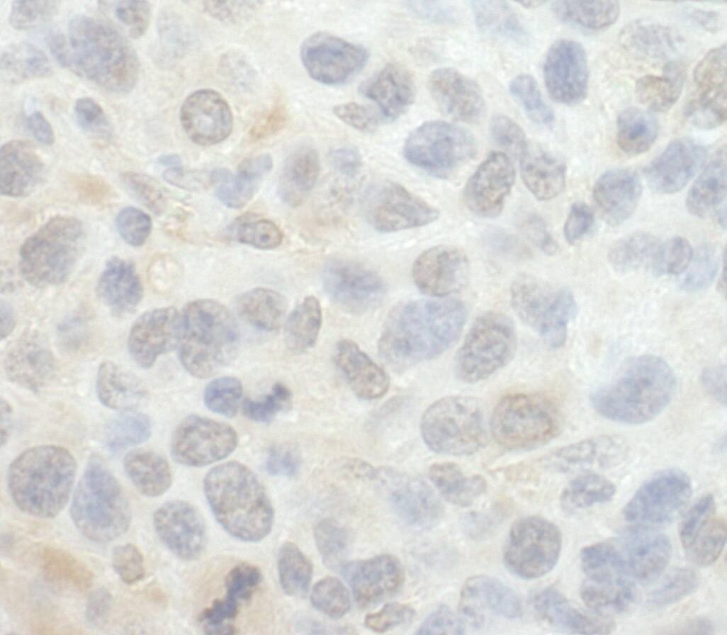 SRPK1 Antibody