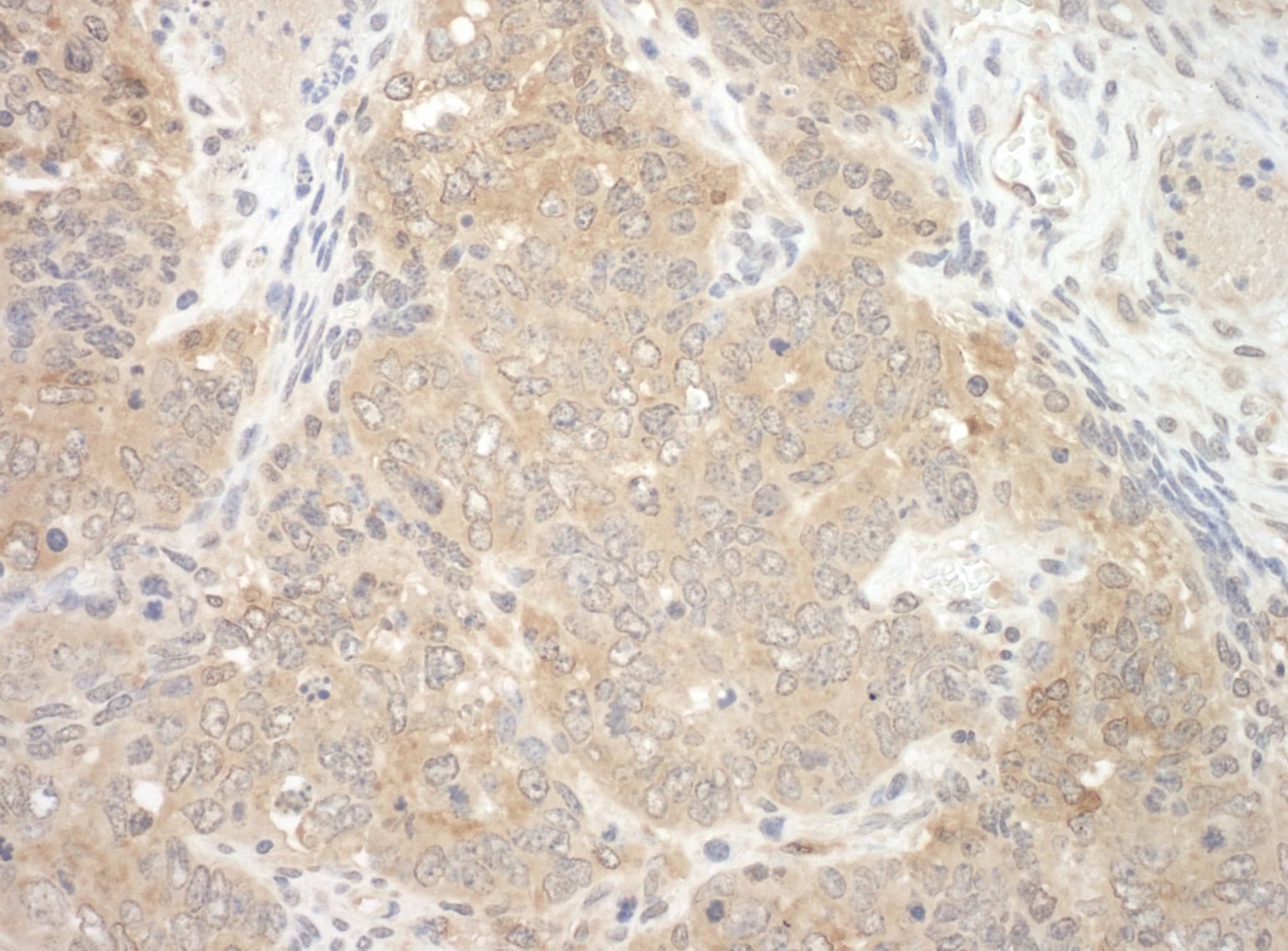 NEDD4L Antibody