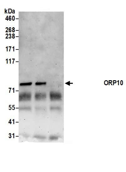 OSBPL10 Antibody