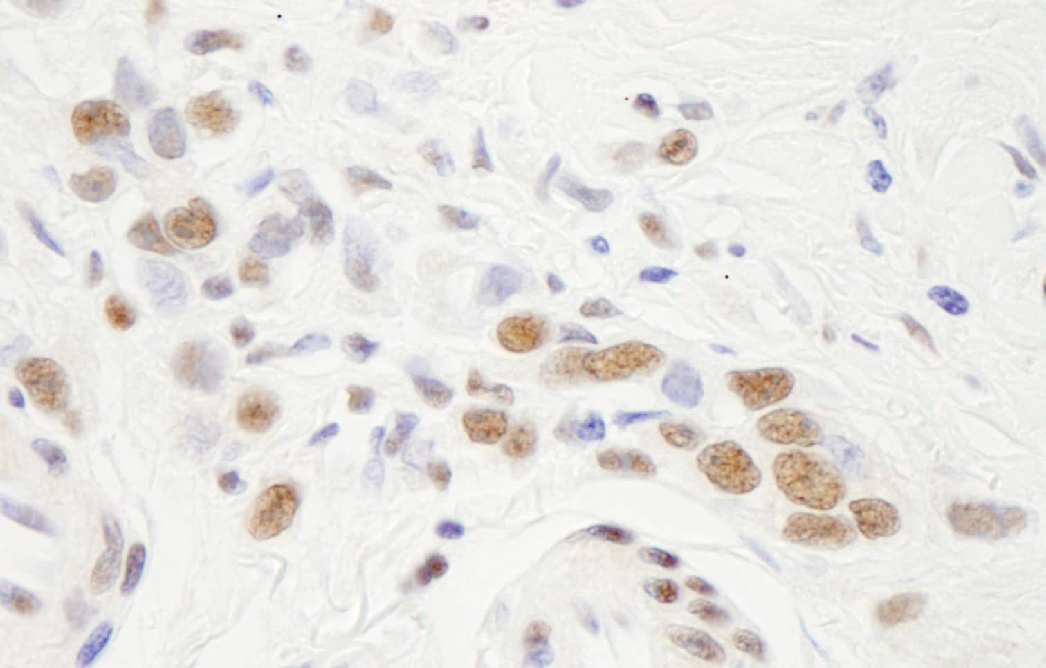 NFYA Antibody