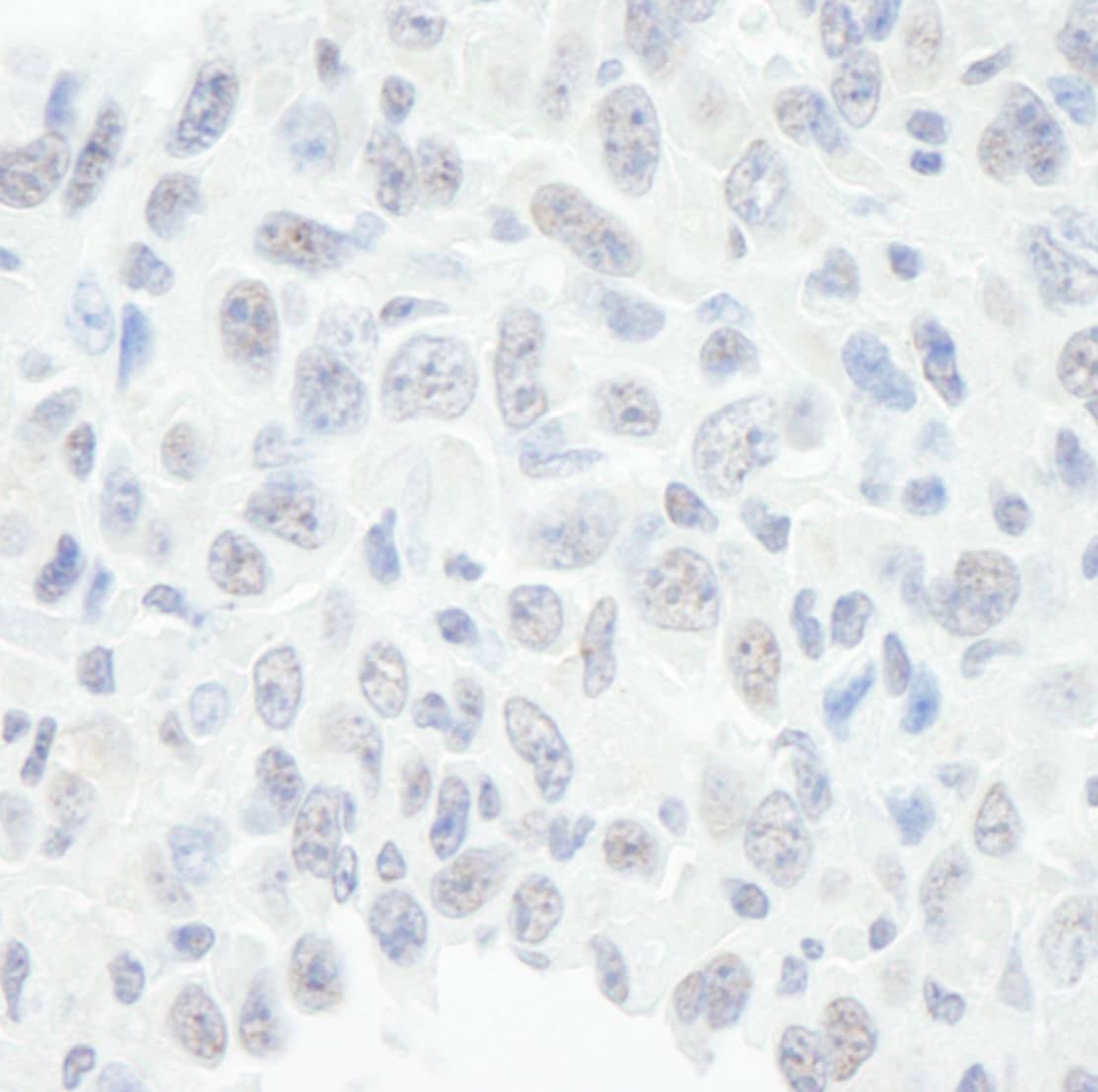 BAF57 Antibody