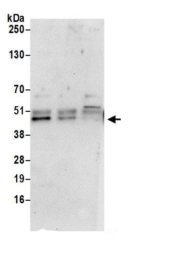 VPS37A Antibody