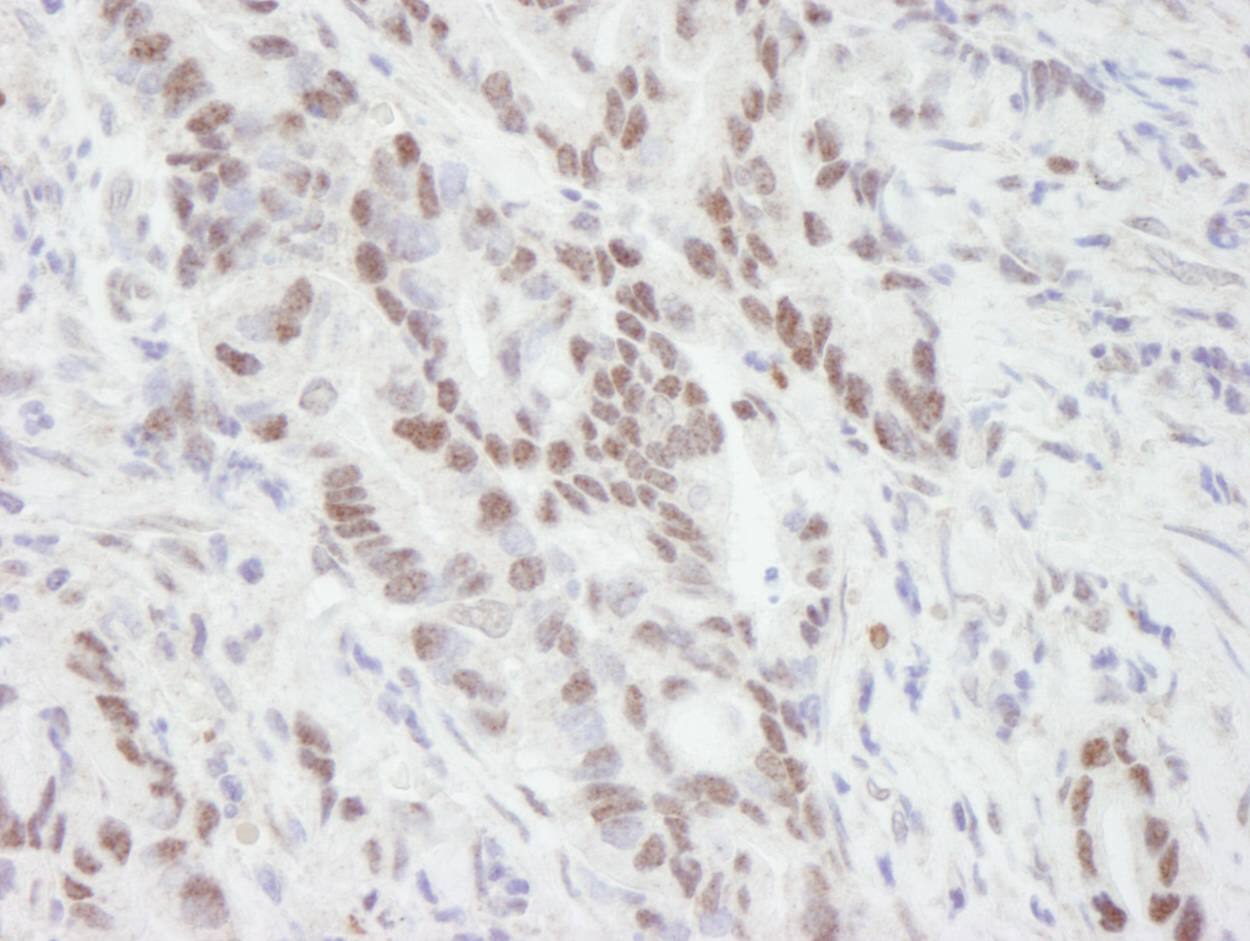 MTA1 Antibody