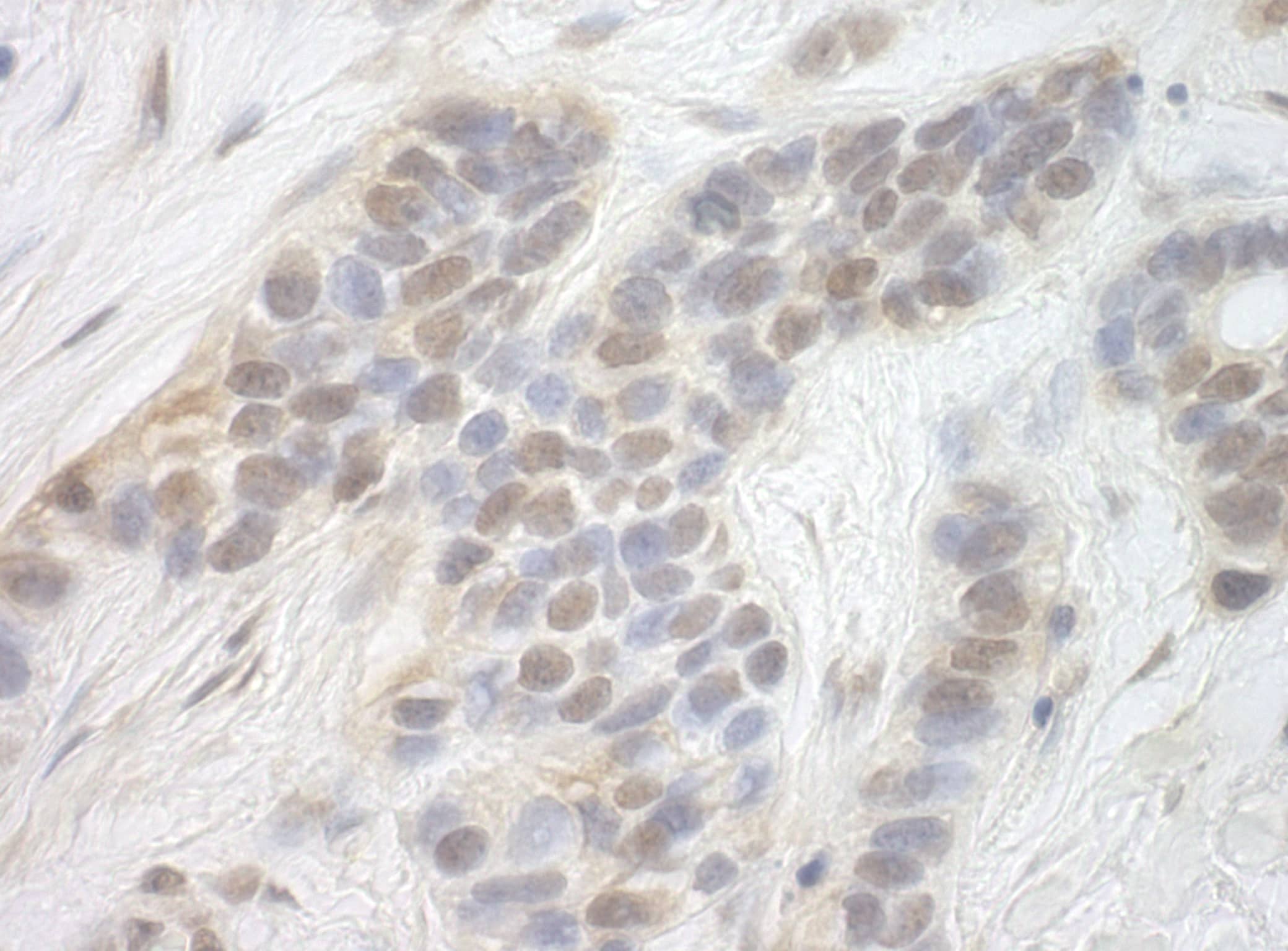 CDK8 Antibody