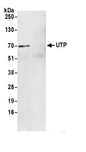UTP15 Antibody