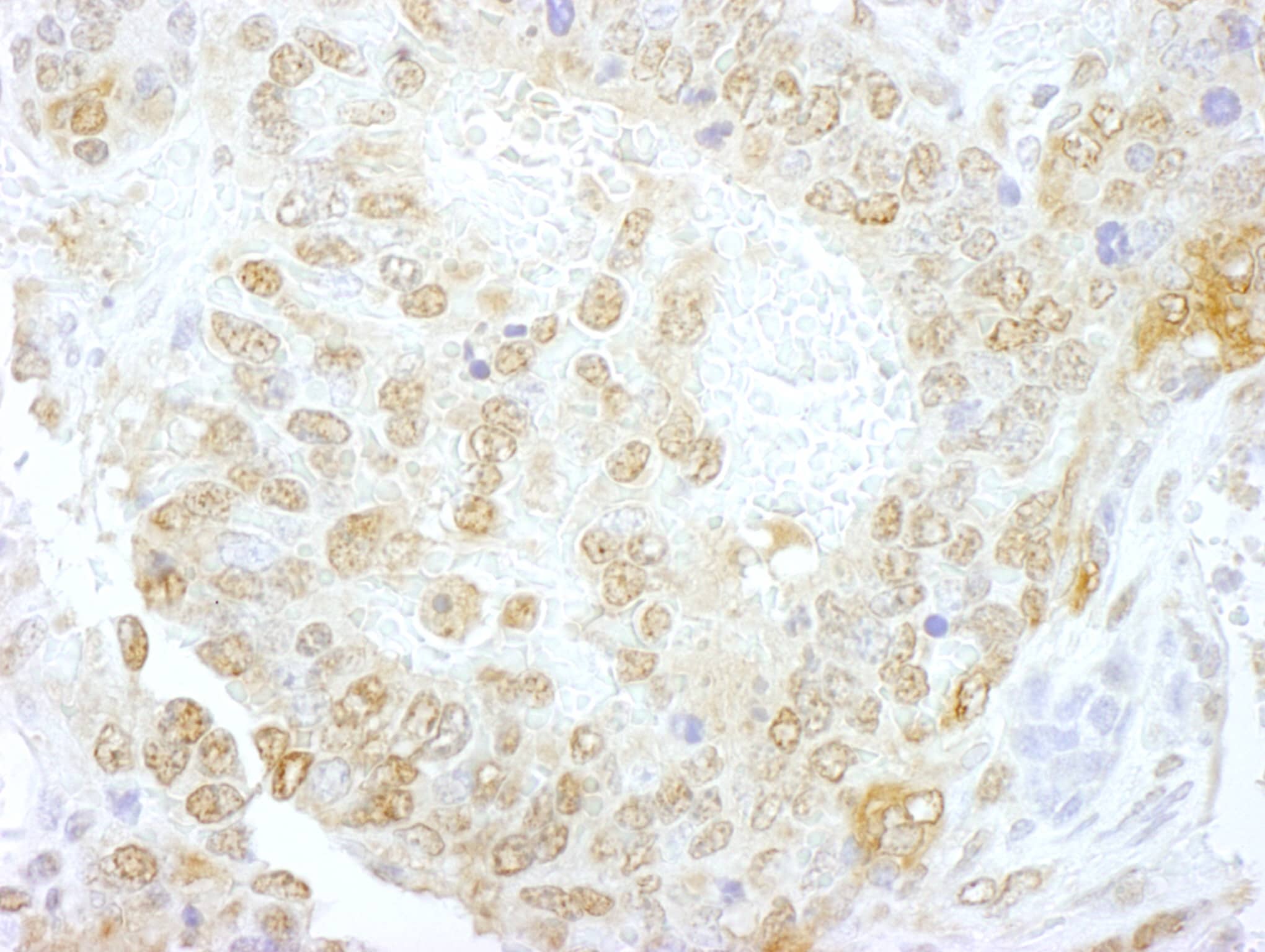 NCBP1 Antibody