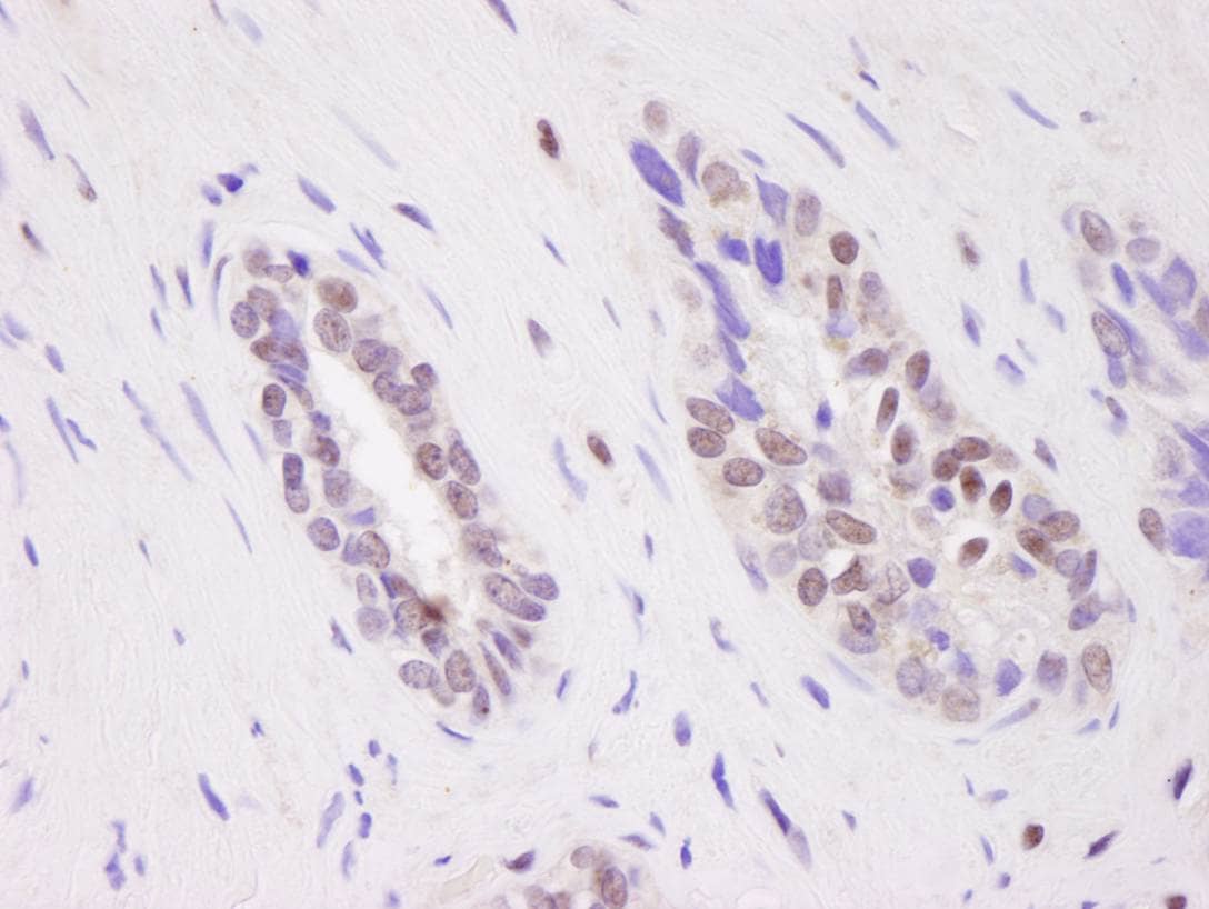 Carm1 Antibody