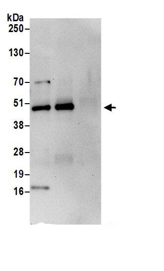 Calumenin Antibody