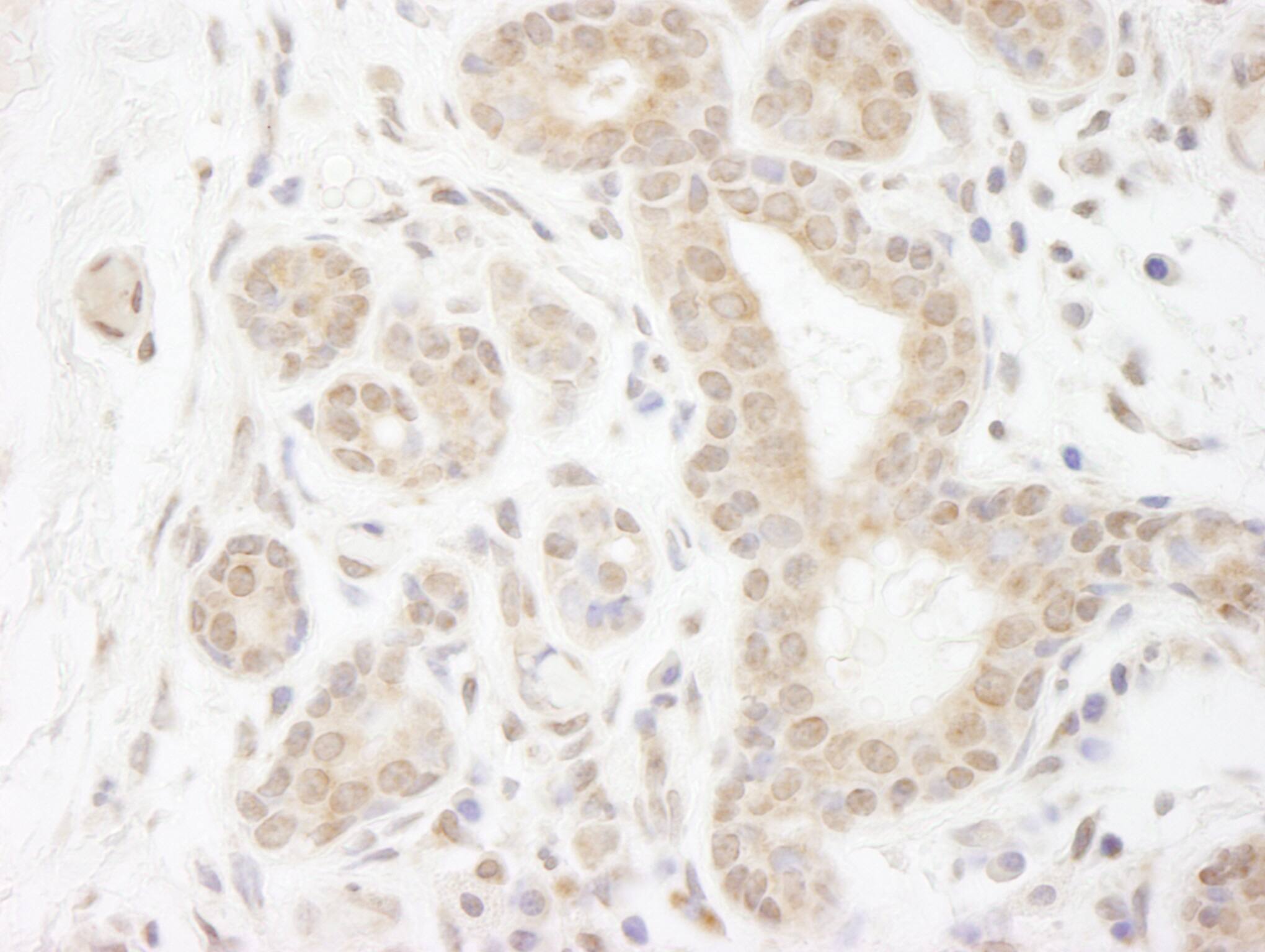 Gemin 3 Antibody