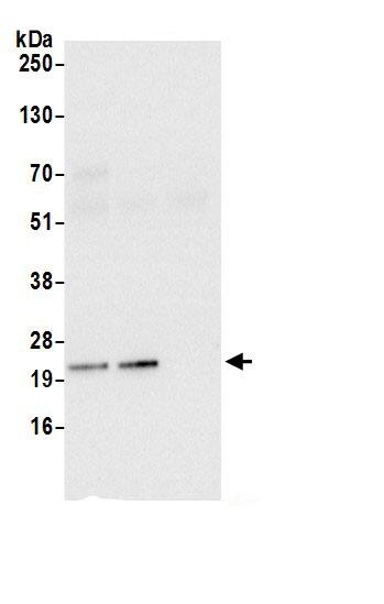 ATP5O Antibody