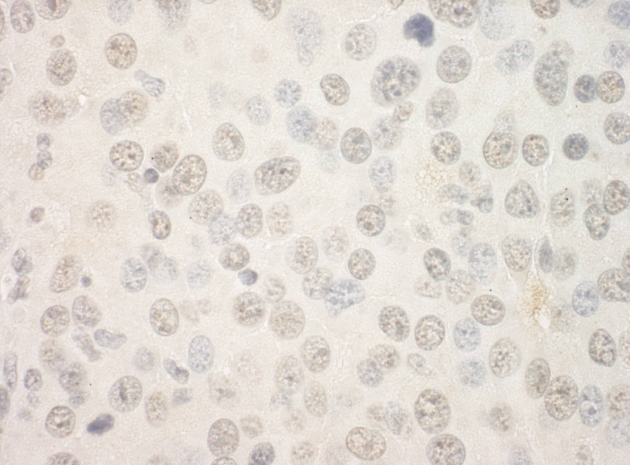 FoxP1 Antibody