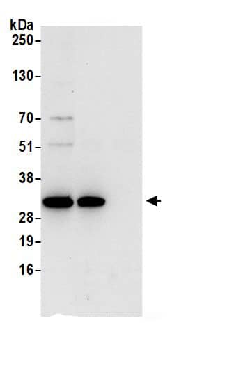 RSU1 Antibody